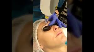 permanent makeup removal microblading