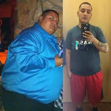 gastric sleeve before and after pic weight loss man on the left before gastric sleeve