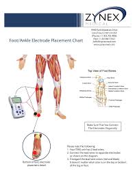 Zmpczm016000 12 15 Foot Ankle Electrode Placement Chart