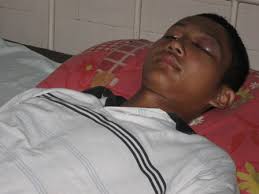 TERBARING--Korban dugaan penganiayaan sekelompok remaja, Ilham P, 16, siswa salah satu SMAN di Wonogiri terbaring di bangsal Mawar, RSUD dr Soediran Mangun ... - KORBAN-PENGANIAYAAN