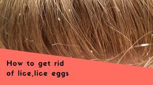 tips to get rid of lice eggs lice eggs
