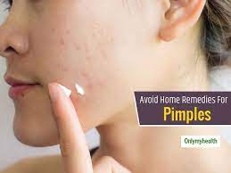 remedy for acne and pimples