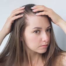diffuse alopecia what is it