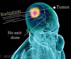 proton therapy lowers risk of cancer