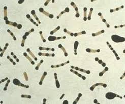 A microbial biorealm page on the genus listeria monocytogenes. Medizinische Mikrobiologie Grampositive Stabchen Wikibooks Sammlung Freier Lehr Sach Und Fachbucher