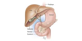 gall bladder stone treatment removal