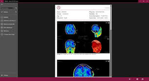 Our software can be used to convert jpeg, bmp images to dicom images. Athena Dicom Viewer For Windows 10 Pc Free Download Best Windows 10 Apps