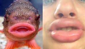 giving s fish lips