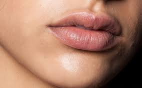 how chapped lips could be caused by dry