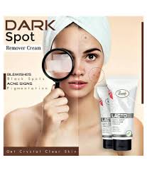 Types of dark spots, black marks and patches on the face, skin. Luster Lacto Dark Spot Remover Cream Face And Under Arms Moisturizer 60 Ml Pack Of 2 Buy Luster Lacto Dark Spot Remover Cream Face And Under Arms Moisturizer 60 Ml