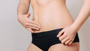 home remes for stretch marks