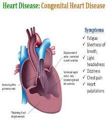 I had been a heavy smoker, my symptoms started out with. Congenial Heart Disease Download Scientific Diagram