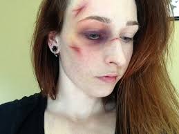 bruised makeup tutorial you