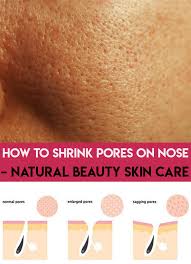 The first type of nose scarring is sunken or holey scars, scientifically known as atrophic scars. How To Shrink Pores On Nose Natural Beauty Skin Care Nose Pores Large Pores Clogged Pores On Nose