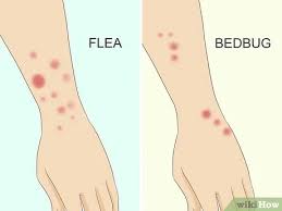 Each of the following pictures of bed bug bites shows typical skin reactions to the insect's saliva. How To Treat Bed Bug Bites 12 Steps With Pictures Wikihow