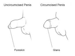 Circumcision Newborn With A Plastibell