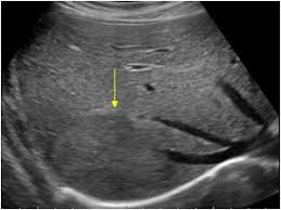    year old Female  Abdominal and Pelvic Pain   Diagnostic Imaging