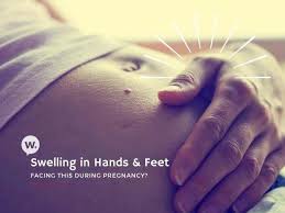 swollen hands and feet during pregnancy