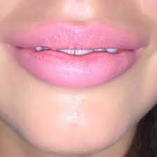 these indentations in my lips are they