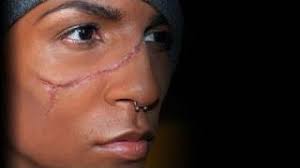 gunshot wound halloween makeup wound