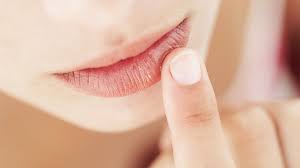 what are chapped lips symptoms causes
