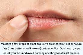 7 home remes for swollen lips