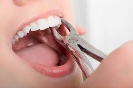 tooth extraction pain