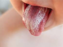 Freepure gets to the source of bad breath. Warning Signs Your Tongue Could Be Sending About Your Health