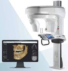 cbct imaging cone beam computed