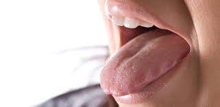 scalloped tongue az dentist
