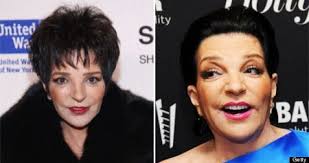 Minnelli recently transferred her mother judy garland's remains from new york to hollywood, which a source says proves the end is near… and liza wants to be laid to rest next to her mother. Liza Minnelli Plastic Surgery Before After Pla Liposculpturebeforeandaf Lipos Plastische Chirurgie Prominente Plastische Chirurgie Wimperntusche