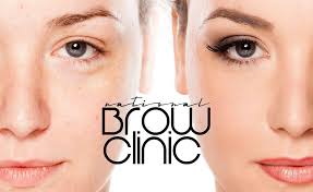 testimonials national brow clinic
