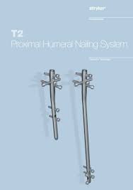 t2 proximal humeral nailing system