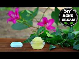 diy acne acne scar removal cream that