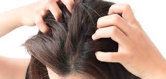 skin rashes caused by itchy scalp