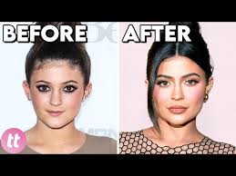 after plastic surgery