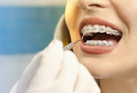 It creates a barrier between the inside of your mouth and your braces, reducing friction and allowing any irritation or sores to heal. Common Braces Problems How To Fix Them Andover Orthodontics