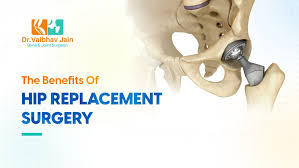what is hip replacement surgery types