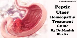 peptic ulcer homeopathy treatment and