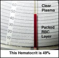 Hematocrit Hit Or Packed Cell Volume Pcv Test Manually