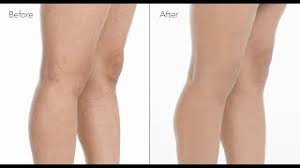 cover spider veins on legs with makeup
