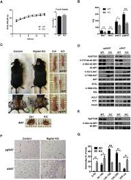 Adipocyte Raptor Ko Mice Develop Lipodystrophy With Age A