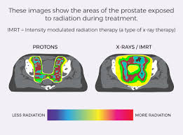 what is proton therapy how does proton
