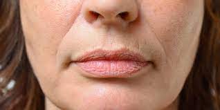 types of lips explained shapes care
