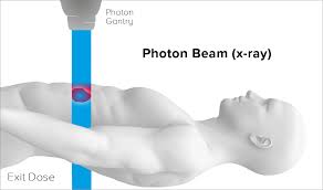 why proton therapy mevion cal systems