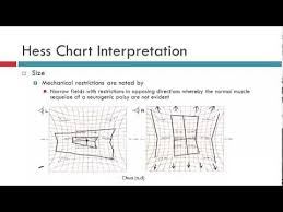 Hess Chart Interpretation