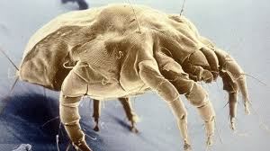 house dust mite allergy