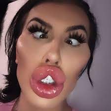 woman with biggest lips in the uk