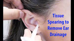 Buy ear drops and get the best deals at the lowest prices on ebay! Antibiotic Ear Drops When And How To Use Ear Drops Properly Youtube