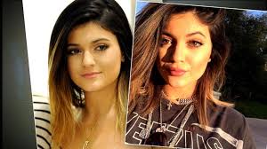 Kylie jenner before plastic surgery you can find fascinating photos! Kylie Jenner Admits I Got Rid Of All My Filler After Fan Comments On Her Lips Abc News